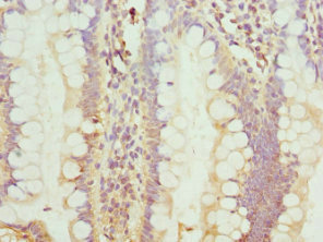 C8orf4 Antibody - Immunohistochemistry of paraffin-embedded human small intestine tissue at dilution 1:100