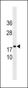 C8orf44 Antibody - C8orf44 Antibody western blot of SK-BR-3 cell line lysates (35 ug/lane). The C8orf44 antibody detected the C8orf44 protein (arrow).