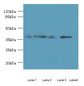 C8orf48 Antibody - Western blot. All lanes: C8orf48 antibody at 1 ug/ml. Lane 1: HepG-2 whole cell lysate. Lane 2: Mouse liver tissue. Lane 3: MCF7 whole cell lysate. Lane 4: K562 whole cell lysate. Secondary Goat polyclonal to Rabbit IgG at 1:10000 dilution. Predicted band size: 37 kDa. Observed band size: 37 kDa.