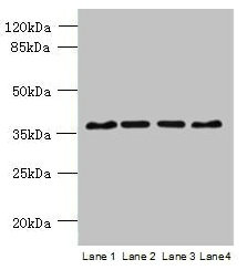 C8orf48 Antibody - Western blot All lanes: C8orf48 antibody at 1µg/ml Lane 1: HepG2 whole cell lysate Lane 2: Mouse liver tissue Lane 3: MCF-7 whole cell lysate Lane 4: K562 whole cell lysate Secondary Goat polyclonal to rabbit IgG at 1/10000 dilution Predicted band size: 37 kDa Observed band size: 37 kDa