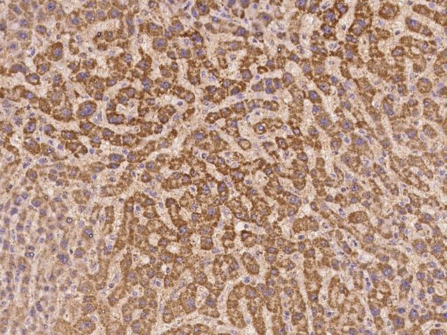 C8orf86 Antibody - Immunochemical staining of human C8orf86 in human liver with rabbit polyclonal antibody at 1:100 dilution, formalin-fixed paraffin embedded sections.