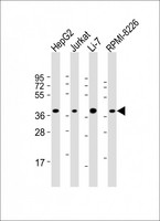C9orf100 Antibody - All lanes: Anti-C9orf100 Antibody (Center) at 1:2000 dilution. Lane 1: HepG2 whole cell lysate. Lane 2: Jurkat whole cell lysate. Lane 3: Li-7 whole cell lysate. Lane 4: RPMI-8226 whole cell lysate Lysates/proteins at 20 ug per lane. Secondary Goat Anti-Rabbit IgG, (H+L), Peroxidase conjugated at 1:10000 dilution. Predicted band size: 38 kDa. Blocking/Dilution buffer: 5% NFDM/TBST.