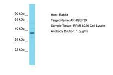 C9orf100 Antibody -  This image was taken for the unconjugated form of this product. Other forms have not been tested.