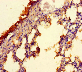 C9orf117 Antibody - Immunohistochemistry of paraffin-embedded human lung tissue using CFAP157 Antibody at dilution of 1:100