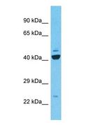 C9orf135 Antibody - Western blot of C9orf135 Antibody with human 786-0 Whole Cell lysate.  This image was taken for the unconjugated form of this product. Other forms have not been tested.