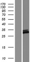 C9orf135 Protein - Western validation with an anti-DDK antibody * L: Control HEK293 lysate R: Over-expression lysate