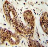C9orf150 Antibody - CI150 Antibody immunohistochemistry of formalin-fixed and paraffin-embedded human breast tissue followed by peroxidase-conjugated secondary antibody and DAB staining.
