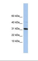 C9orf153 Antibody - HepG2 cell lysate. Antibody concentration: 1.0 ug/ml. Gel concentration: 10-20%.  This image was taken for the unconjugated form of this product. Other forms have not been tested.
