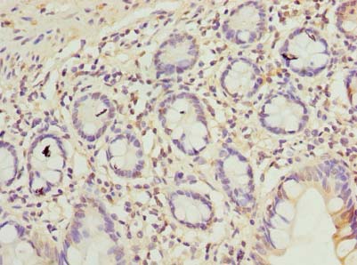 C9orf16 Antibody - Immunohistochemistry of paraffin-embedded human small intestine tissue using antibody at dilution of 1:100.
