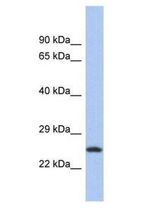 C9orf173 Antibody - C9orf173 antibody Western Blot of THP-1. Antibody dilution: 1 ug/ml.  This image was taken for the unconjugated form of this product. Other forms have not been tested.