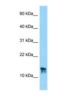 C9orf25 Antibody - C9orf25 antibody Western blot of Mouse Thymus lysate. Antibody concentration 1 ug/ml.  This image was taken for the unconjugated form of this product. Other forms have not been tested.