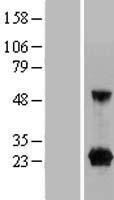 C9orf25 Protein - Western validation with an anti-DDK antibody * L: Control HEK293 lysate R: Over-expression lysate