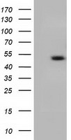 C9orf41 Antibody - HEK293T cells were transfected with the pCMV6-ENTRY control. (Left lane) or pCMV6-ENTRY C9orf41. (Right lane) cDNA for 48 hrs and lysed