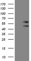 C9orf41 Antibody - HEK293T cells were transfected with the pCMV6-ENTRY control (Left lane) or pCMV6-ENTRY C9orf41 (Right lane) cDNA for 48 hrs and lysed. Equivalent amounts of cell lysates (5 ug per lane) were separated by SDS-PAGE and immunoblotted with anti-C9orf41.