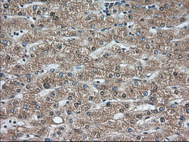 C9orf41 Antibody - Immunohistochemical staining of paraffin-embedded Human liver tissue within the normal limits using anti-C9orf41 mouse monoclonal antibody. (Heat-induced epitope retrieval by 10mM citric buffer, pH6.0, 100C for 10min, Dilution 1:50)