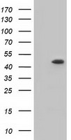 C9orf41 Antibody - HEK293T cells were transfected with the pCMV6-ENTRY control (Left lane) or pCMV6-ENTRY C9orf41 (Right lane) cDNA for 48 hrs and lysed. Equivalent amounts of cell lysates (5 ug per lane) were separated by SDS-PAGE and immunoblotted with anti-C9orf41.
