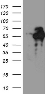 C9orf43 Antibody - HEK293T cells were transfected with the pCMV6-ENTRY control. (Left lane) or pCMV6-ENTRY C9orf43. (Right lane) cDNA for 48 hrs and lysed. Equivalent amounts of cell lysates. (5 ug per lane) were separated by SDS-PAGE and immunoblotted with anti-C9orf43. (1:500)