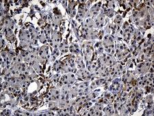 C9orf43 Antibody - Immunohistochemical staining of paraffin-embedded Human pancreas tissue within the normal limits using anti-C9orf43 mouse monoclonal antibody. (Heat-induced epitope retrieval by 1mM EDTA in 10mM Tris buffer. (pH8.5) at 120°C for 3 min. (1:500)