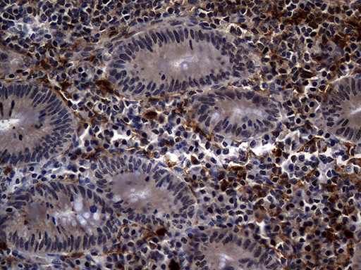 C9orf43 Antibody - Immunohistochemical staining of paraffin-embedded Human appendix tissue within the normal limits using anti-C9orf43 mouse monoclonal antibody. (Heat-induced epitope retrieval by 1mM EDTA in 10mM Tris buffer. (pH8.5) at 120°C for 3 min. (1:500)
