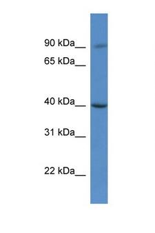 C9orf64 Antibody - C9orf64 antibody Western blot of HeLa Cell lysate. Antibody concentration 1 ug/ml.  This image was taken for the unconjugated form of this product. Other forms have not been tested.