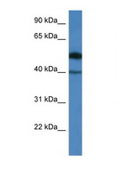 C9orf64 Antibody - C9orf64 antibody Western blot of COL0205 Cell lysate. Antibody concentration 1 ug/ml.  This image was taken for the unconjugated form of this product. Other forms have not been tested.