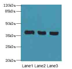 C9orf64 Antibody - Western blot. All lanes: C9orf64 antibody at 1 ug/ml. Lane 1: HeLa whole cell lysate. Lane 2: K562 whole cell lysate. Lane 3: HepG-2 whole cell lysate. Secondary Goat polyclonal to Rabbit IgG at 1:10000 dilution. Predicted band size: 39 kDa. Observed band size: 39 kDa.