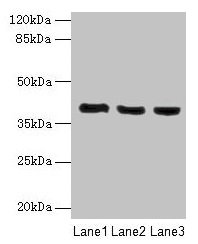 C9orf64 Antibody - Western blot All lanes: C9orf64 antibody at 1µg/ml Lane 1: Hela whole cell lysate Lane 2: K562 whole cell lysate Lane 3: HepG2 whole cell lysate Secondary Goat polyclonal to rabbit IgG at 1/10000 dilution Predicted band size: 39 kDa Observed band size: 39 kDa