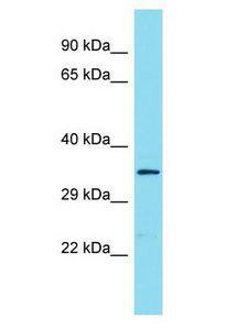 C9orf66 Antibody - C9orf66 antibody Western Blot of COLO205. Antibody dilution: 1 ug/ml.  This image was taken for the unconjugated form of this product. Other forms have not been tested.
