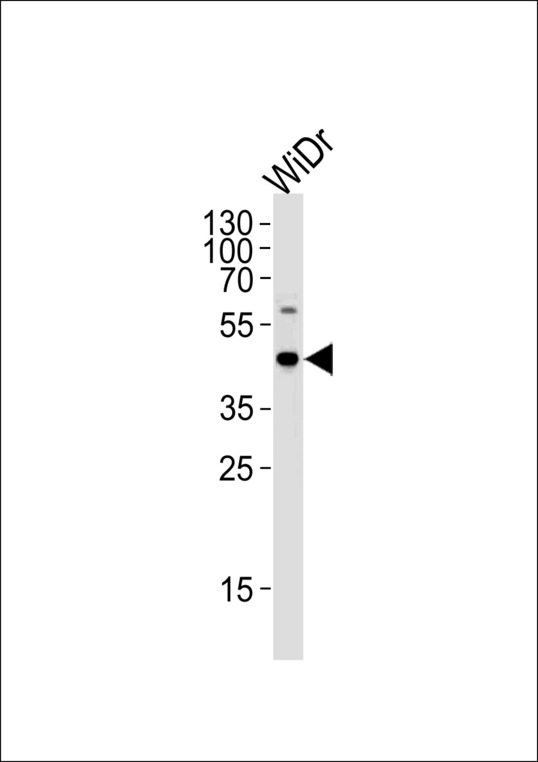 C9orf72 / ALSFTD Antibody - C9orf72 Antibody western blot of WiDr cell lysate (35 ug/lane). This demonstrates that the C9orf72 antibody detected C9orf72 protein (arrow).