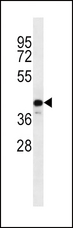 C9orf72 / ALSFTD Antibody - C9orf72 Antibody western blot of MDA-MB231 cell line lysates (35 ug/lane). The C9orf72 antibody detected the C9orf72 protein (arrow).