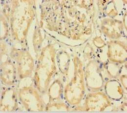 C9orf72 / ALSFTD Antibody - Immunohistochemistry of paraffin-embedded human kidney tissue using C9orf72 Antibody at dilution of 1:100
