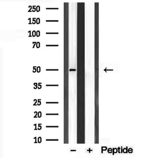 C9orf72 / ALSFTD Antibody - Western blot analysis of extracts of rat brain tissue using C9orf72 antibody.