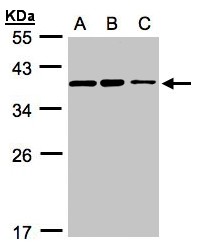 C9orf78 Antibody - Sample (30 ug whole cell lysate). A: H1299, B: HeLa S3, C: Hep G2 . 12% SDS PAGE. C9orf78 antibody diluted at 1:3000