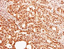 C9orf78 Antibody - IHC of paraffin-embedded NCI-N87 xenograft using C9orf78 antibody at 1:500 dilution.