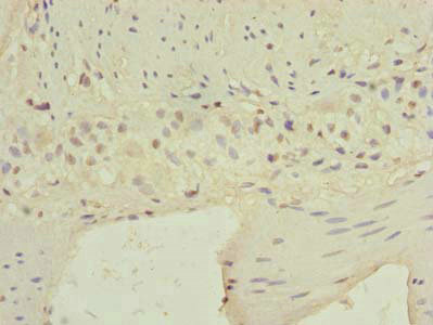 C9orf89 Antibody - Immunohistochemistry of paraffin-embedded human small intestine tissue using CARD19 Antibody at dilution of 1:100