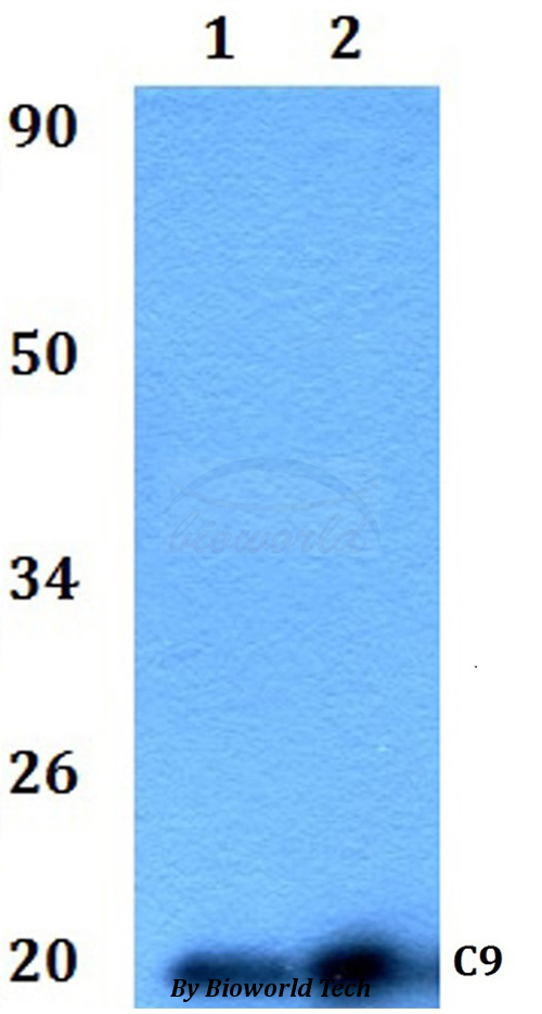 C9orf89 Antibody - Western blot of C9orf89 antibody at 1:500 dilution Line1:HeLa whole cell lysate Line2:H9C2 whole cell lysate.