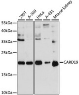 C9orf89 Antibody - Western blot analysis of extracts of various cell lines, using CARD19 antibody at 1:3000 dilution. The secondary antibody used was an HRP Goat Anti-Rabbit IgG (H+L) at 1:10000 dilution. Lysates were loaded 25ug per lane and 3% nonfat dry milk in TBST was used for blocking. An ECL Kit was used for detection and the exposure time was 90s.