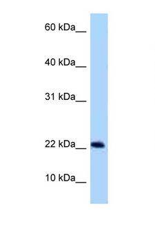 C9orf9 Antibody - C9orf9 antibody Western blot of Rat Muscle lysate. Antibody concentration 1 ug/ml.  This image was taken for the unconjugated form of this product. Other forms have not been tested.