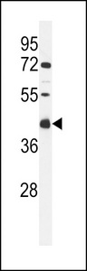 C9orf91 Antibody - Western blot of CI091 Antibody in MCF-7 cell line lysates (35 ug/lane). CI091 (arrow) was detected using the purified antibody.