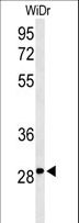 C9orf95 / NRK1 Antibody - Western blot of C9orf95 Antibody in WiDr cell line lysates (35 ug/lane). C9orf95 (arrow) was detected using the purified antibody.