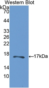 CA-VB / CA5B Antibody