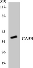 CA-VB / CA5B Antibody - Western blot analysis of the lysates from HT-29 cells using CA5B antibody.