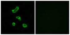 CA-VB / CA5B Antibody - Immunofluorescence analysis of MCF7 cells, using CA5B Antibody. The picture on the right is blocked with the synthesized peptide.
