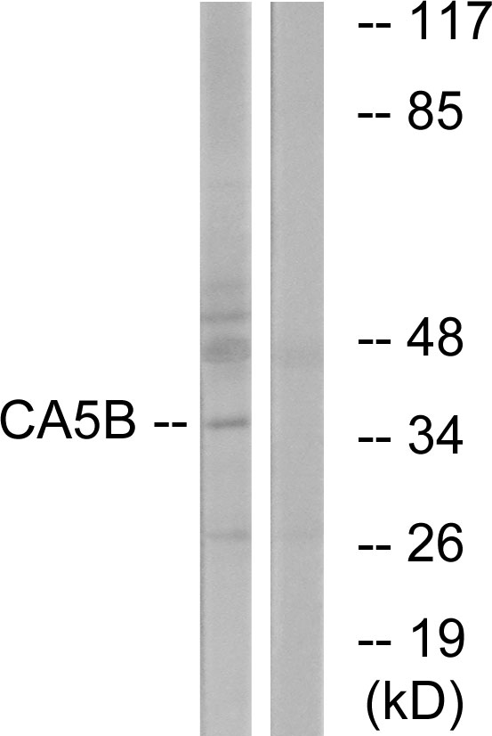 CA-VB / CA5B Antibody - Western blot analysis of lysates from NIH/3T3 cells, using CA5B Antibody. The lane on the right is blocked with the synthesized peptide.