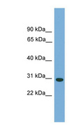 CA-VB / CA5B Antibody - CA5B antibody Western blot of THP-1 cell lysate. This image was taken for the unconjugated form of this product. Other forms have not been tested.