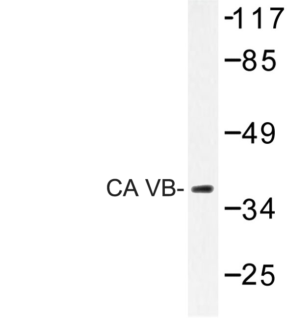 CA-VB / CA5B Antibody - Western blot of CA VB (N280) pAb in extracts from 3T3 cells.