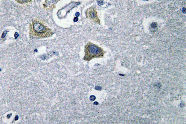 CA-VB / CA5B Antibody - IHC of CA VB (N280) pAb in paraffin-embedded human brain tissue.