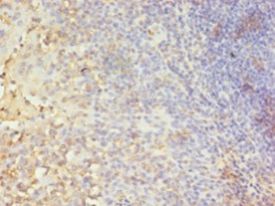 CA-VB / CA5B Antibody - Immunohistochemistry of paraffin-embedded human tonsil tissue using antibody at 1:100 dilution.  This image was taken for the unconjugated form of this product. Other forms have not been tested.