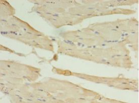 CA-VB / CA5B Antibody - Immunohistochemistry of paraffin-embedded human skeletal muscle tissue using antibody at 1:100 dilution.  This image was taken for the unconjugated form of this product. Other forms have not been tested.