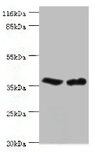 CA-VB / CA5B Antibody - Western blot All lanes: CA5B antibody at 2µg/ml Lane 1: Mouse liver tissue Lane 2: Mouse kidney tissue Secondary Goat polyclonal to rabbit IgG at 1/10000 dilution Predicted band size: 36 kDa Observed band size: 36 kDa